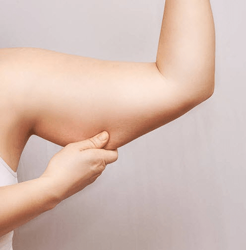 burn arm fat, reducing arm fat
